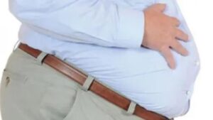 السمنة، فقدان الوزن، وجراحة استبدال المفاصل