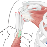 Ao https://surgeryreference.aofoundation.org