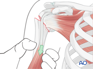 Ao https://surgeryreference.aofoundation.org