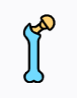 arthroplasty