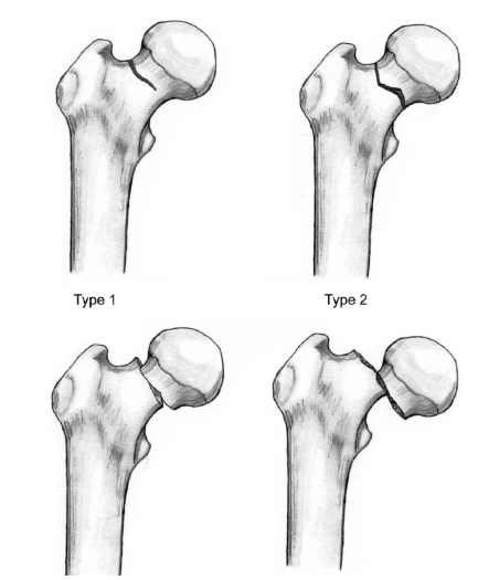 garden classification