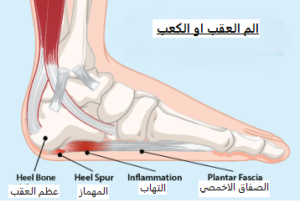 heel pain