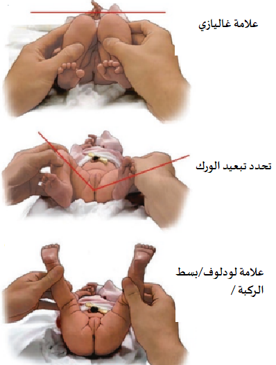 طرق فحص الوليد من 0-4 اشهر