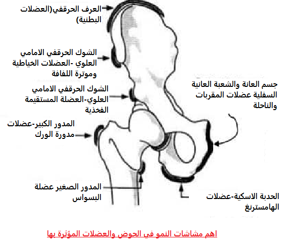 التهاب مراكز نمو عظام الحوض عند الأطفال المراهقين.