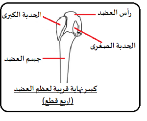 كسور أعلى عظم العضد (الكتف) عند كبار السن: الدليل الشامل للفهم، العلاج، والتعافي 3 راس عضد