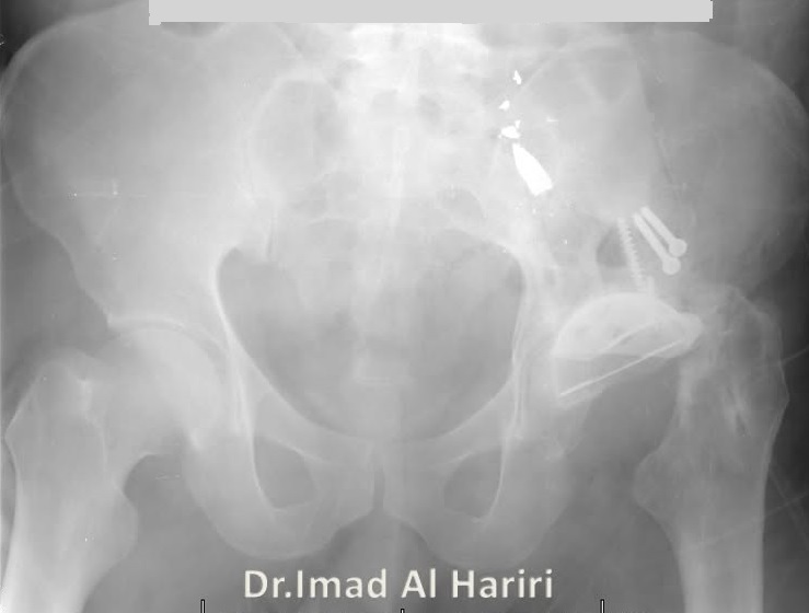 صورة 3
