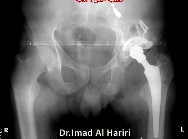 صورة 4