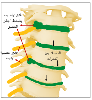 داء الفقرات الرقبية التنكسي-تشريح الفقرات