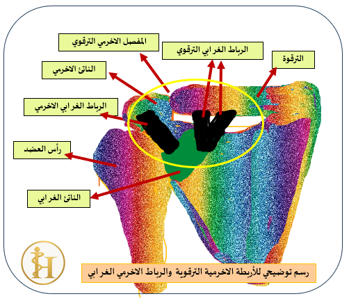 نقل الرباط الغرابي الأخرمي -رسم توضيحي للاربطة الغرابية الترقوية والاخرمية الغرابية